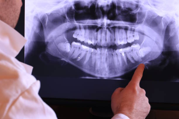 Best Emergency Dental Care for Abscessed Tooth in Buffalo, TX
