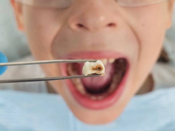 Best Orthodontic Emergency Dentist in Buffalo, TX